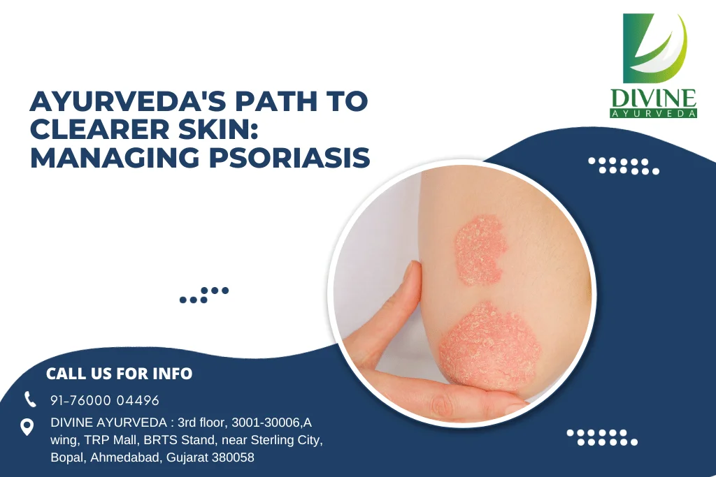 PSORIASIS FACTS AND COMPLETE AYURVEDIC CURE