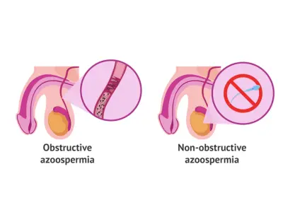 Azoospermia