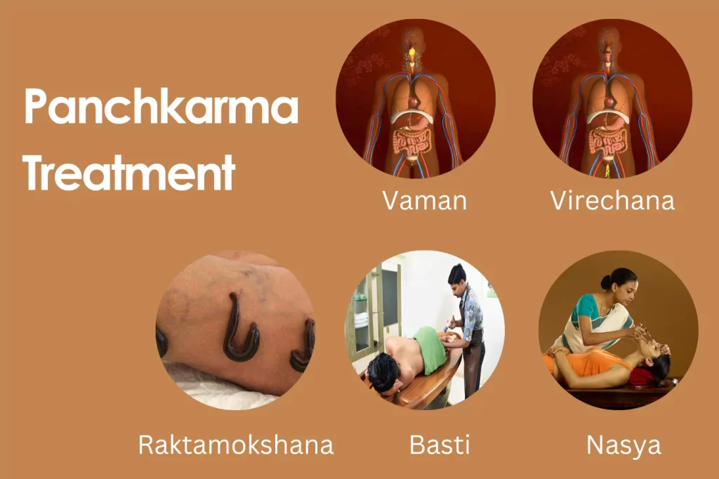 Panchkarma Treatment